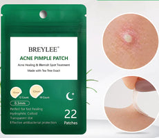 Overnight Acne Patches for Clear Skin